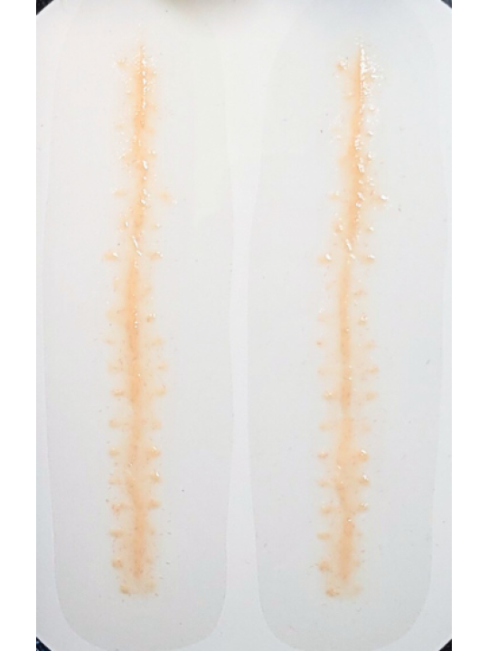 Healing long stitches
