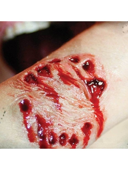 Human Bite
