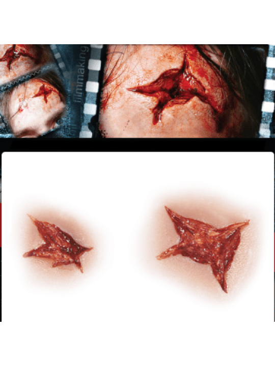 STAR INJURY