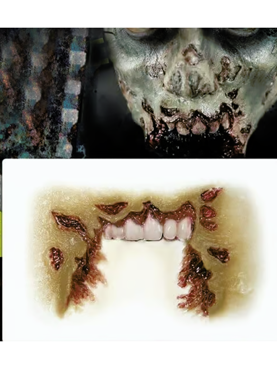 Missing Jaw