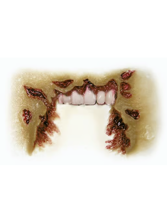 Missing Jaw