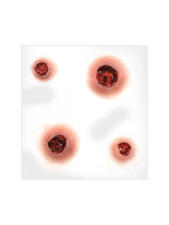 Bullet Wound