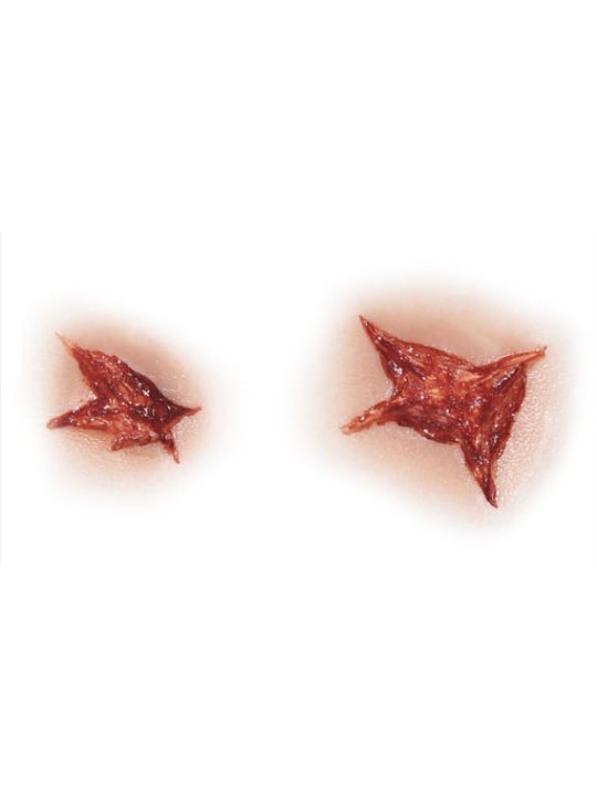 STAR INJURY
