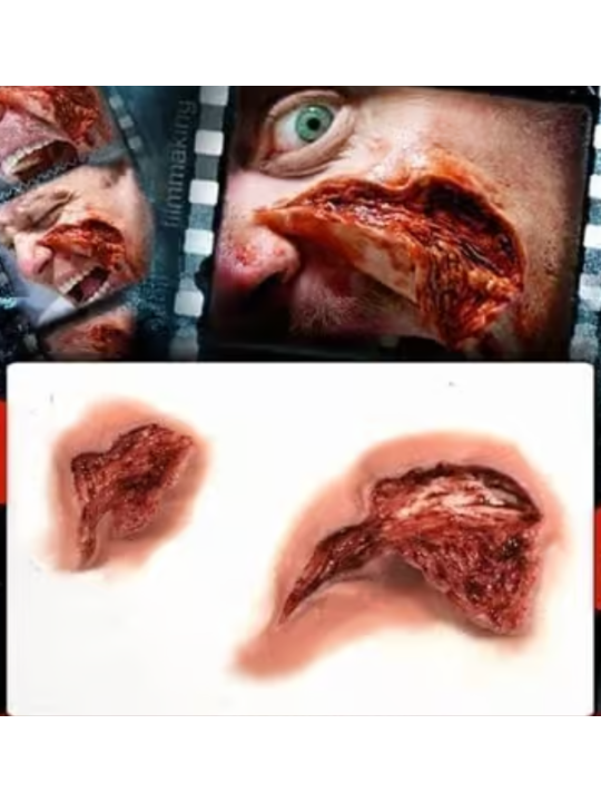 Gouge injury 