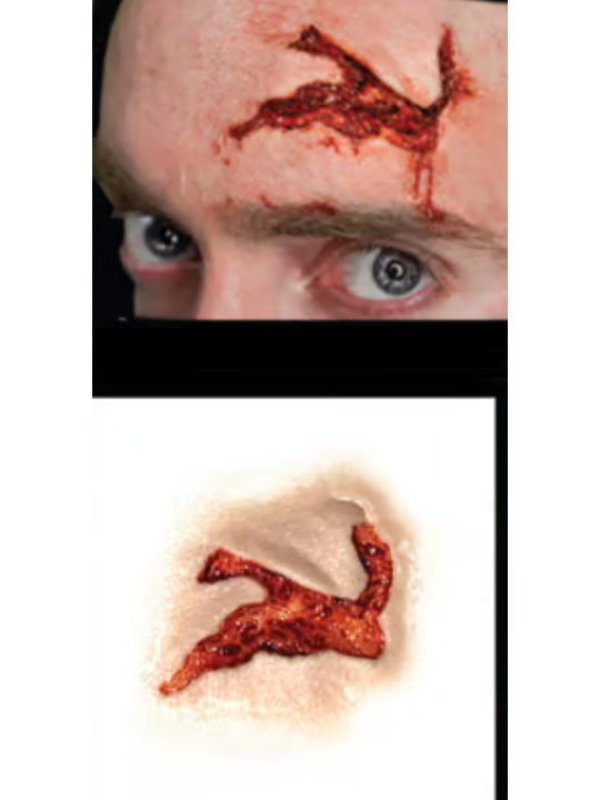 Head Wound